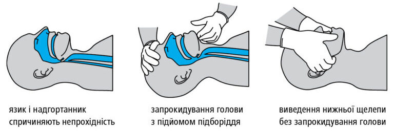 Як відновити дихання